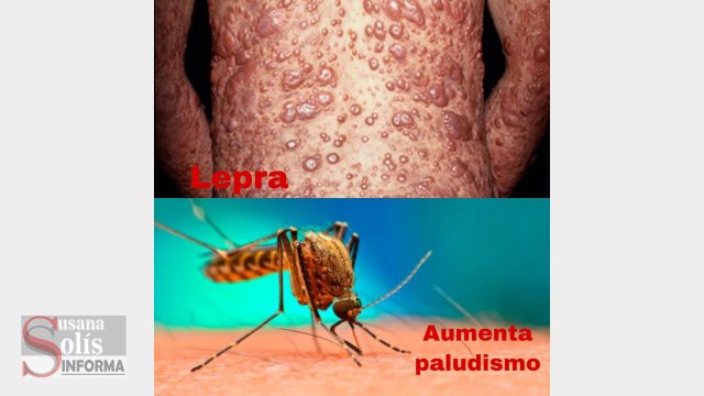 Susana Solis Informa REPORTAN casos de lepra en Chiapas y aumento de paludismo