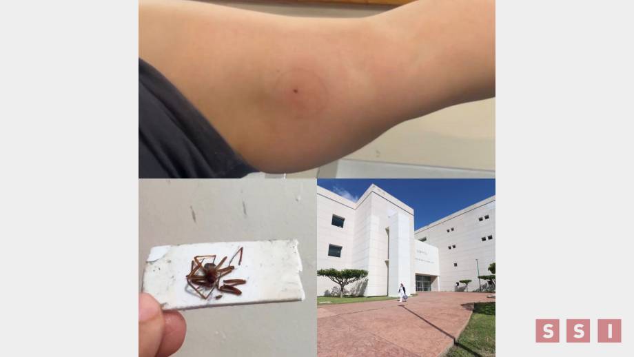 SALVAN vida de mujer que sufrió picadura de araña violinista - Susana Solis Informa