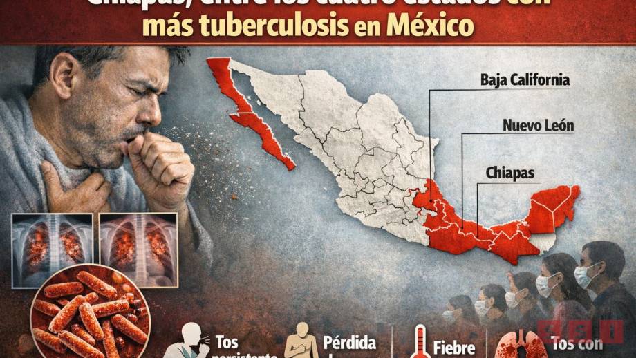 Chiapas, entre los cuatro estados con más tuberculosis en México - Susana Solis Informa
